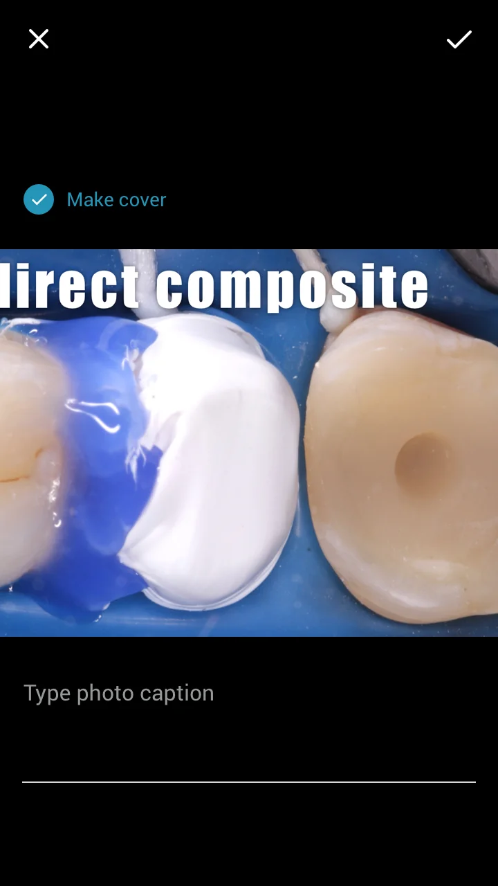 Clicking on the photo will open this page to write the caption and select cover photo